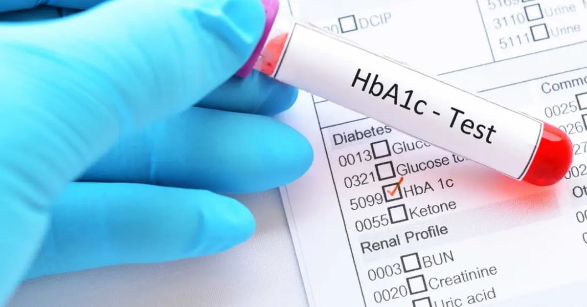 Why The HbA1c Test Is So Important & How To Control It